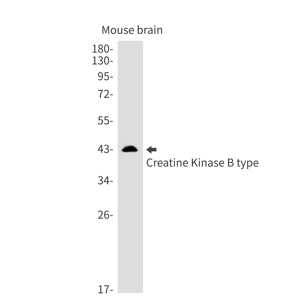 2 - [KD]Creatine Kinase B type Rabbit mAb AP75289