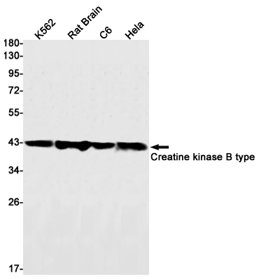 8 - [KD]Creatine Kinase B type Rabbit mAb AP75289