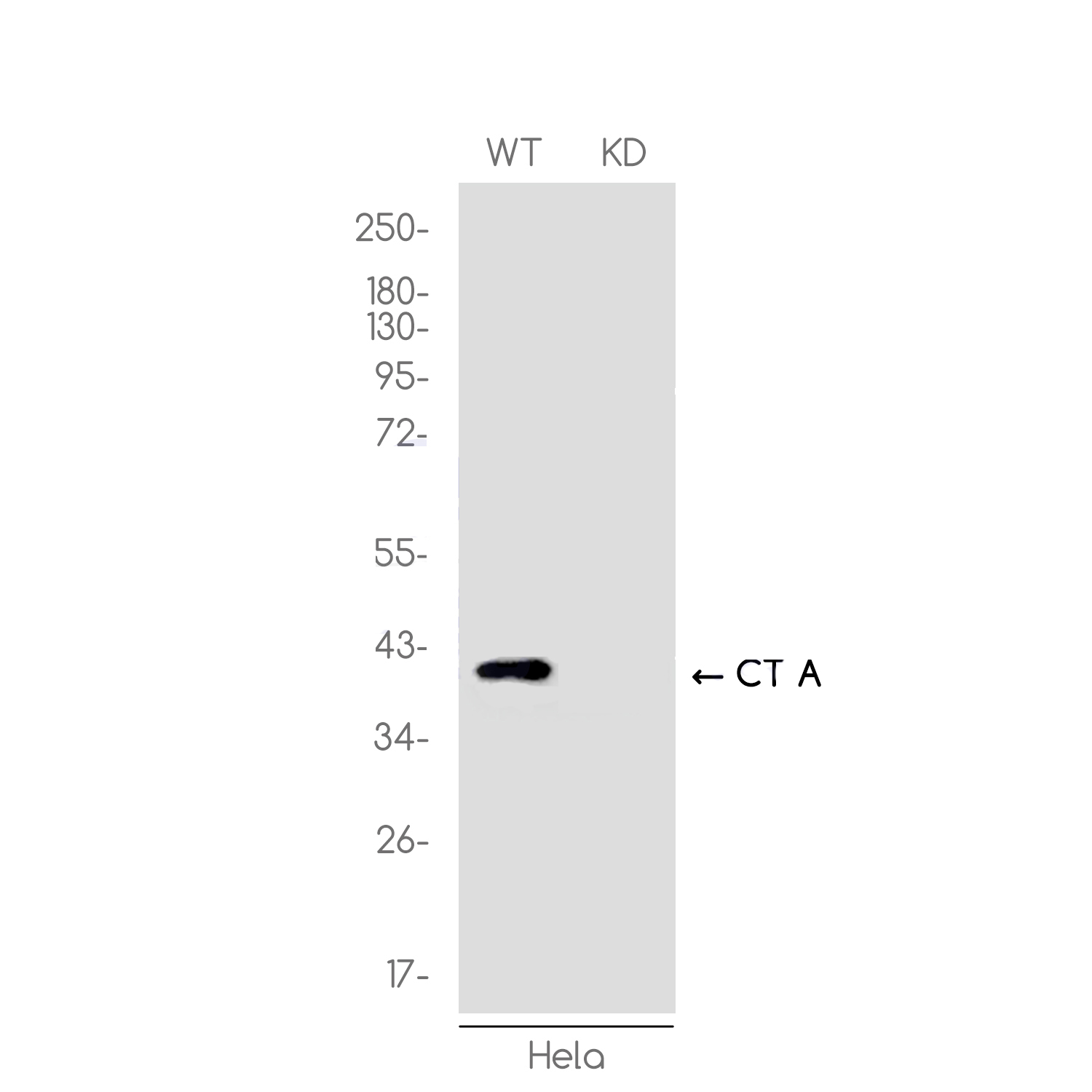 1 - [KD]CT A Rabbit mAb AP75296