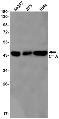 2 - [KD]CT A Rabbit mAb AP75296