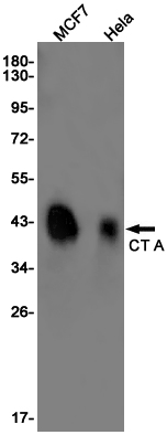 1 - CT A Rabbit mAb AP75297