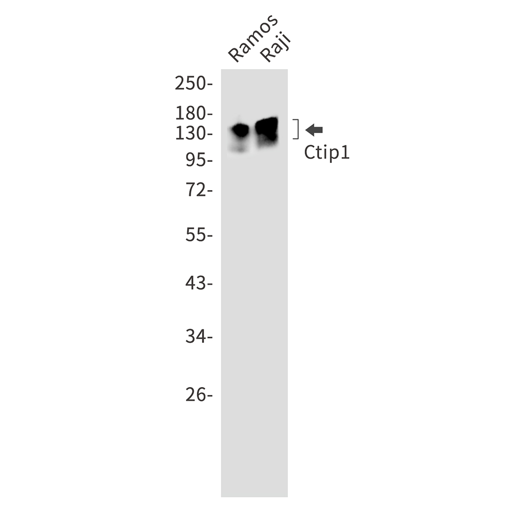 1 - Ctip1/BCL-11A Rabbit mAb AP75299
