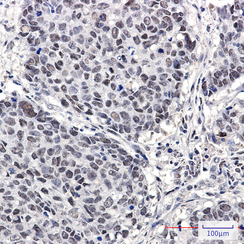 2 - Cullin 4A/4B Rabbit mAb AP75306