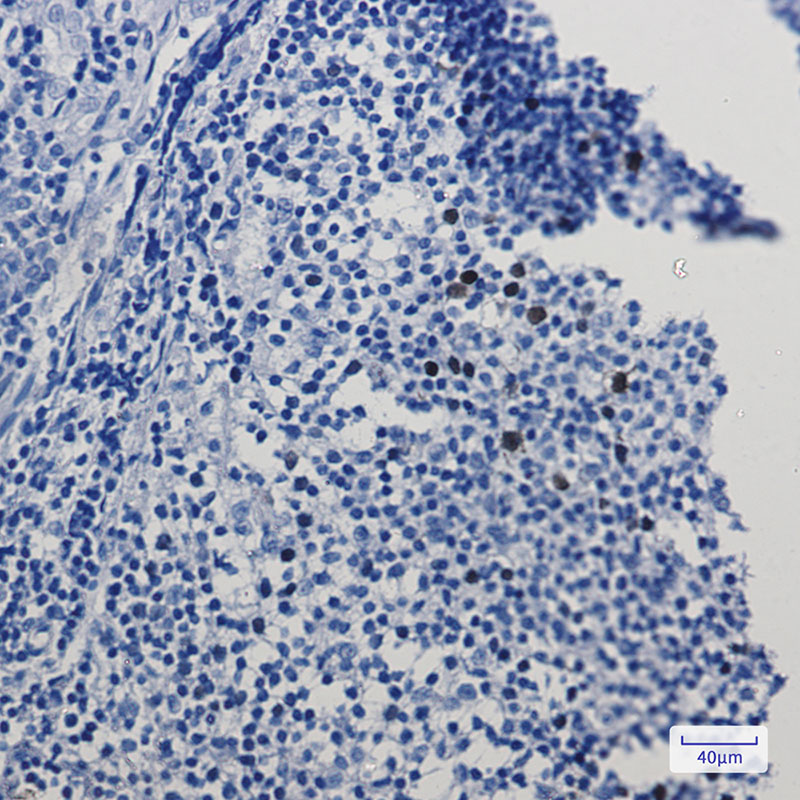 8 - Cyclin A2 Rabbit mAb AP75311