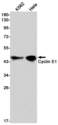 8 - [KD]Cyclin E1 Rabbit mAb AP75313