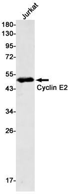 1 - Cyclin E2 Rabbit mAb AP75314