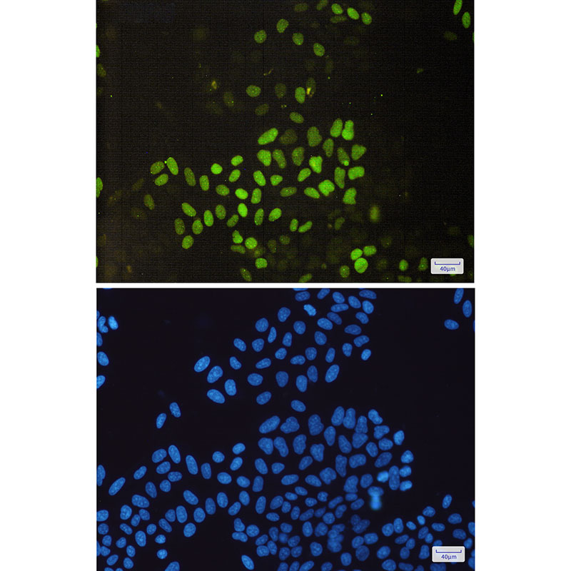 8 - [KO]Cyclin E2 Rabbit mAb AP75315