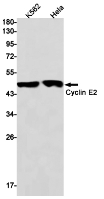 2 - [KO]Cyclin E2 Rabbit mAb AP75315