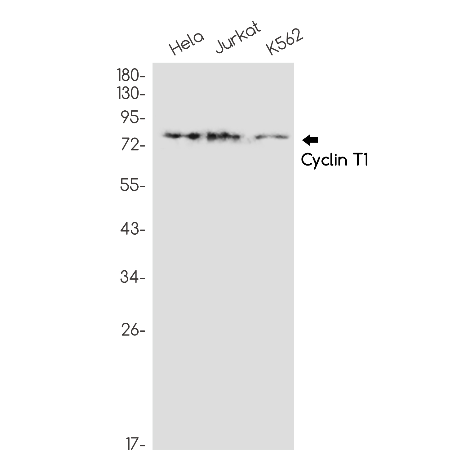 2 - [KD]Cyclin T1 Rabbit mAb AP75317