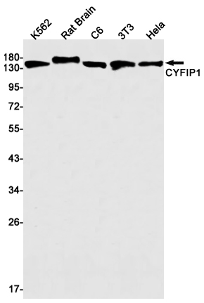 1 - CYFIP1 Rabbit mAb AP75320
