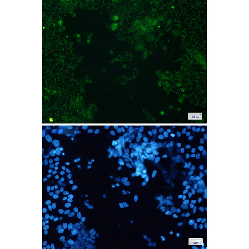 4 - Cytochrome P450 17A1/CYP17A1 Rabbit mAb AP75325