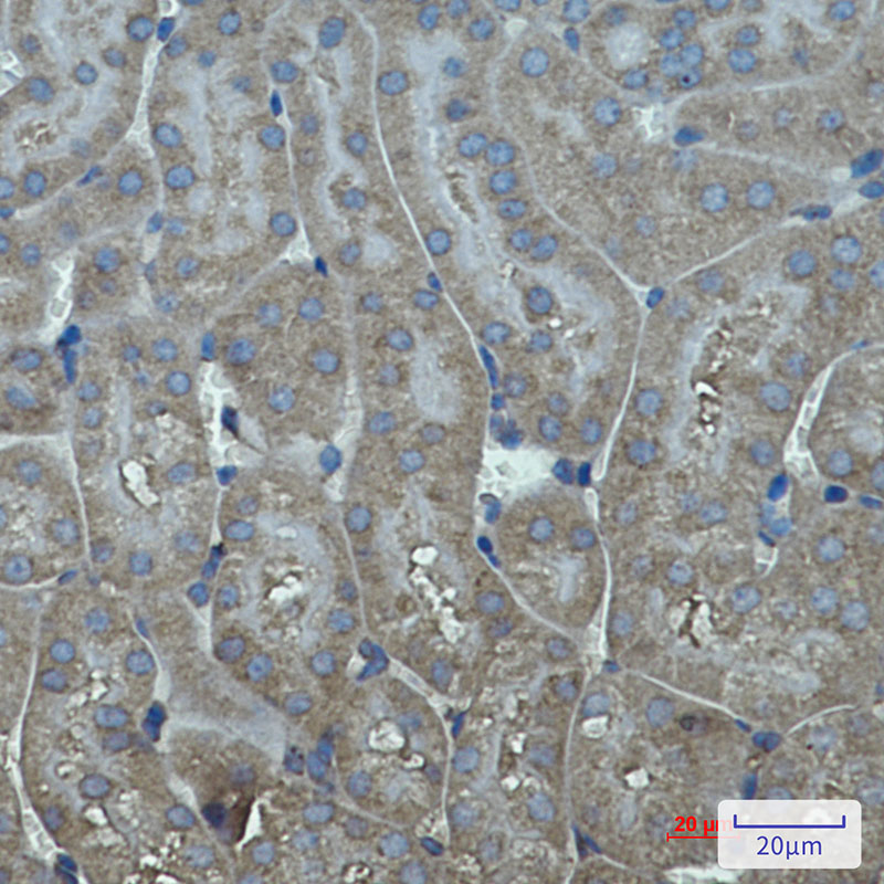 1 - Cytochrome P450 17A1/CYP17A1 Rabbit mAb AP75325