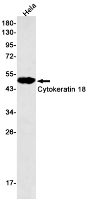 1 - Cytokeratin 18 Rabbit mAb AP75328