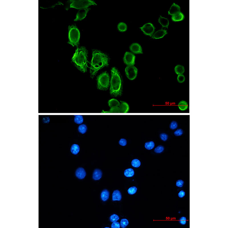 8 - Cytokeratin 19 Rabbit mAb AP75331