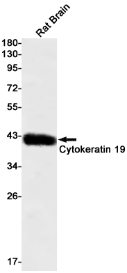 1 - Cytokeratin 19 Rabbit mAb AP75331