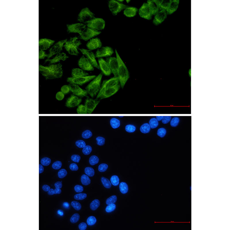 8 - Cytokeratin 7 Rabbit mAb AP75333