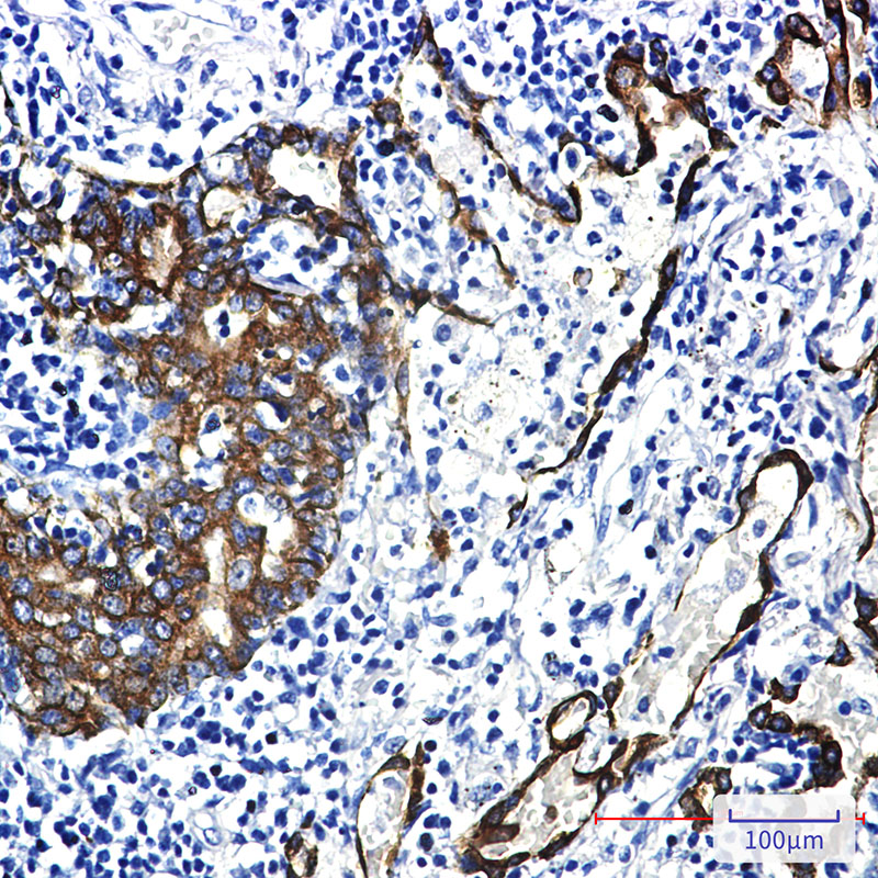 2 - Cytokeratin 7 Rabbit mAb AP75333