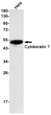 1 - Cytokeratin 7 Rabbit mAb AP75333