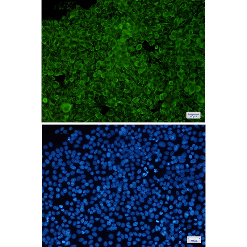 8 - Phospho-Cytokeratin 8 (Ser23) Rabbit mAb AP75334