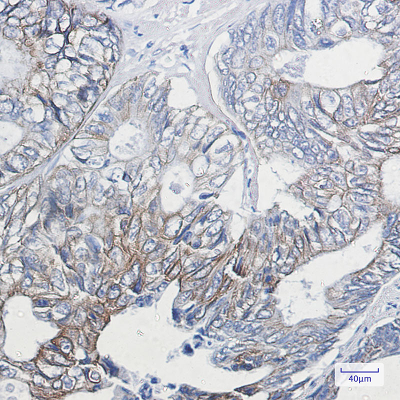 2 - Phospho-Cytokeratin 8 (Ser23) Rabbit mAb AP75334