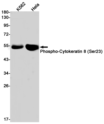 1 - Phospho-Cytokeratin 8 (Ser23) Rabbit mAb AP75334