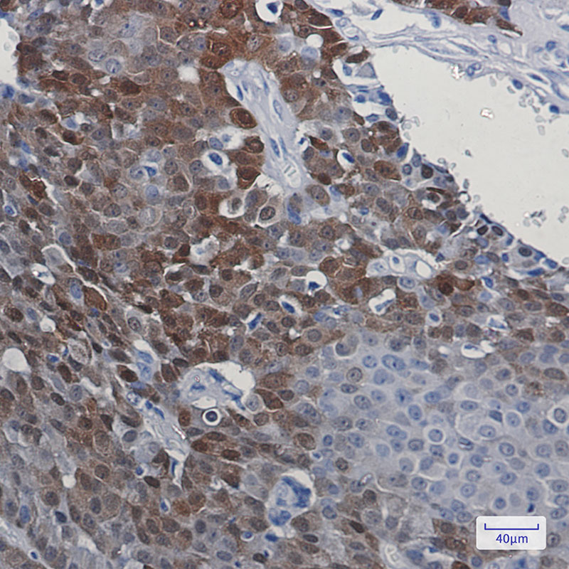 5 - [KD]DARPP32 Rabbit mAb AP75338