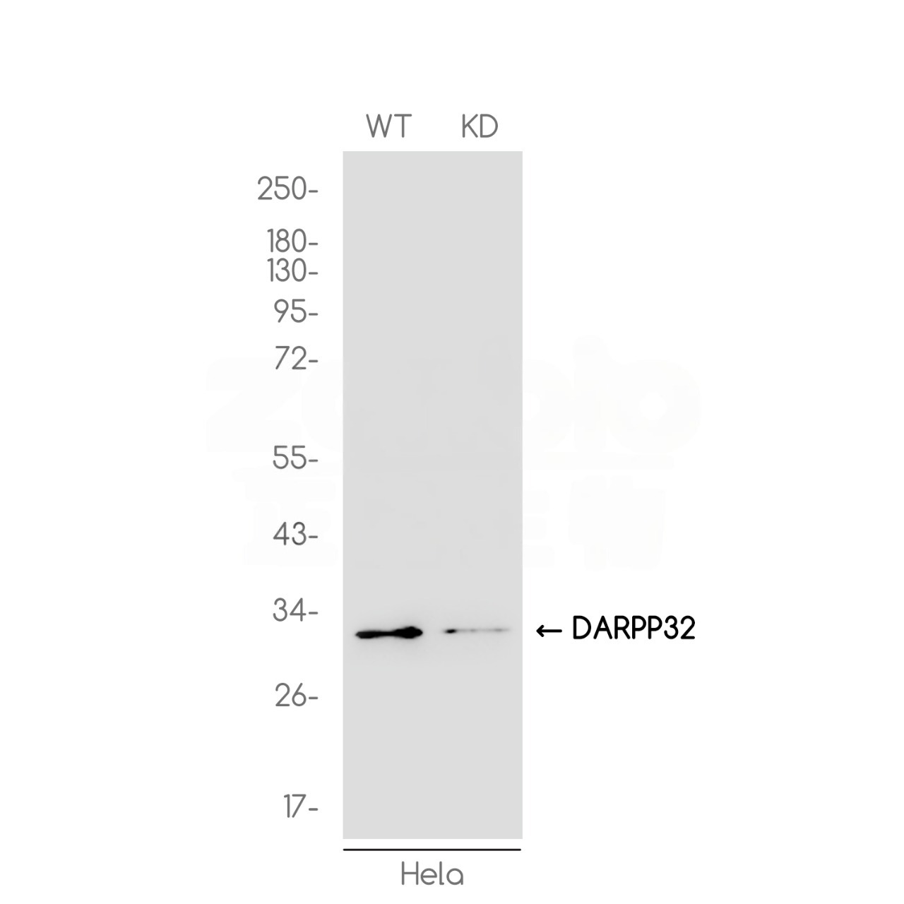 1 - [KD]DARPP32 Rabbit mAb AP75338