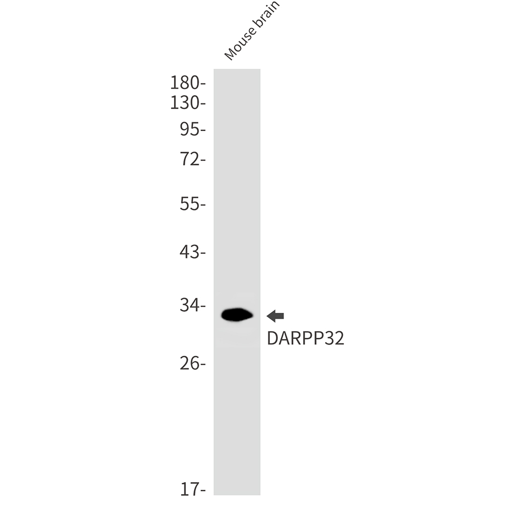 2 - [KD]DARPP32 Rabbit mAb AP75338
