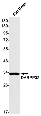 8 - [KD]DARPP32 Rabbit mAb AP75338
