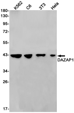 5 - [KO]DAZAP1 Rabbit mAb AP75340