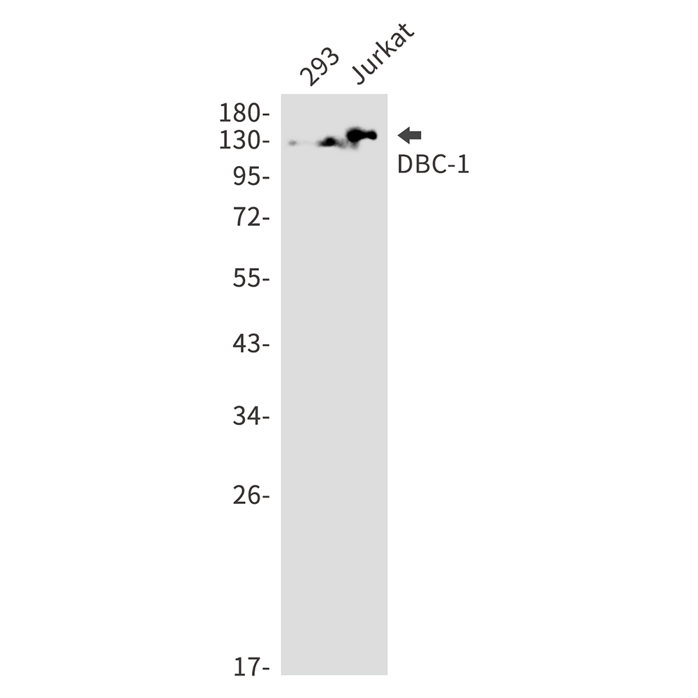1 - DBC 1 Rabbit mAb AP75341