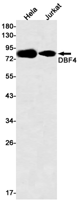 1 - DBF4 Rabbit mAb AP75342