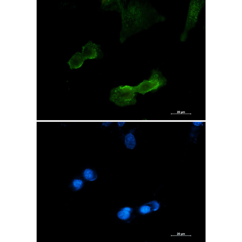 2 - [KD]DCAMKL1 Rabbit mAb AP75343