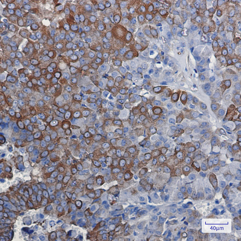 0 - [KD]DCAMKL1 Rabbit mAb AP75343