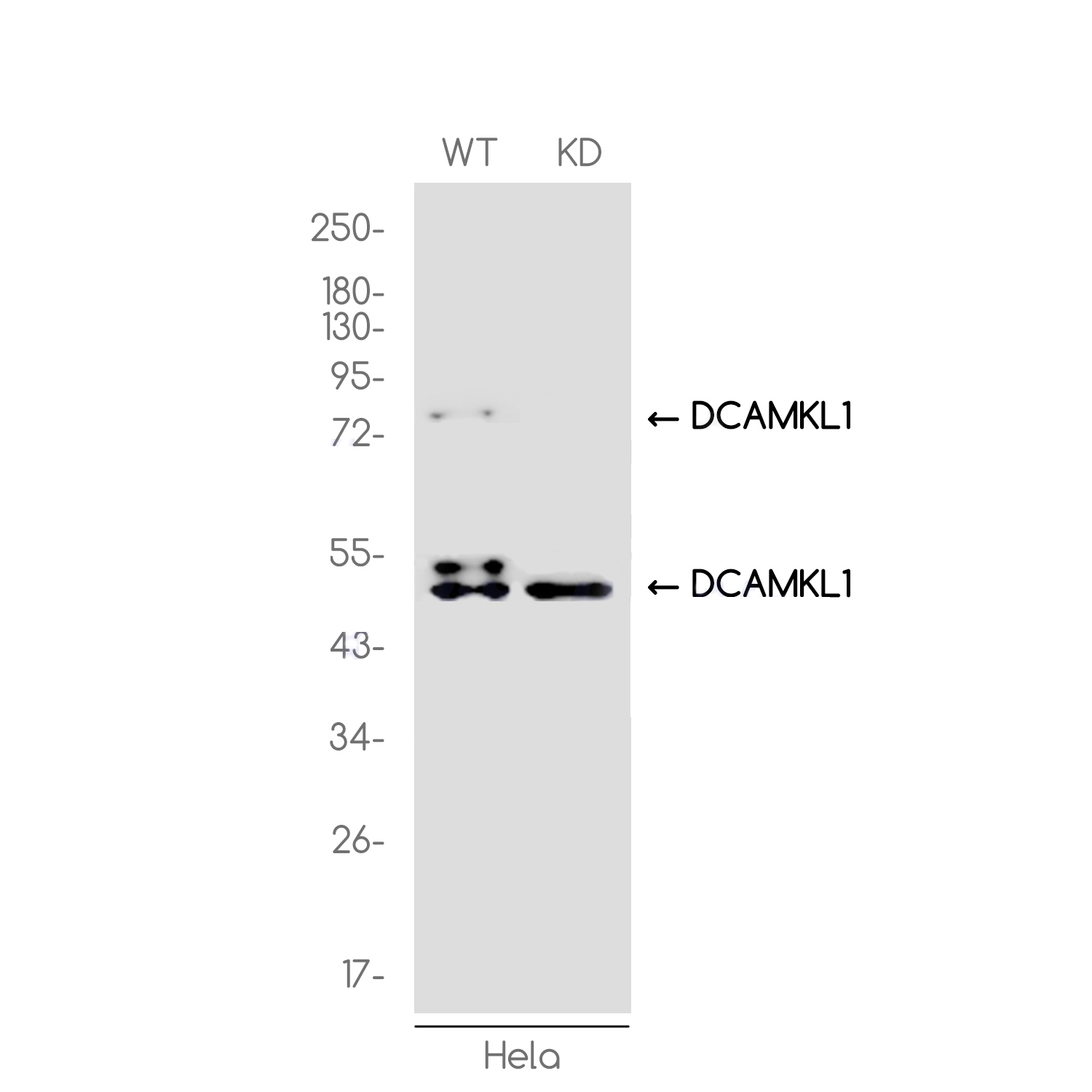 1 - [KD]DCAMKL1 Rabbit mAb AP75343