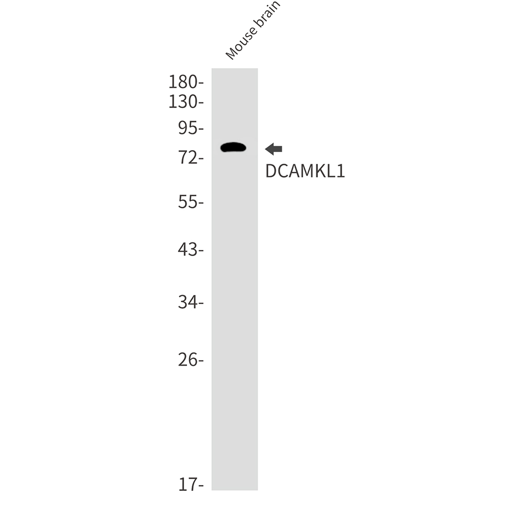 3 - [KD]DCAMKL1 Rabbit mAb AP75343