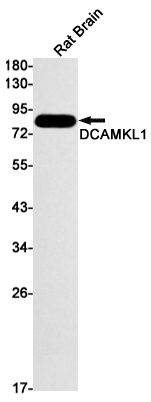 0 - [KD]DCAMKL1 Rabbit mAb AP75343