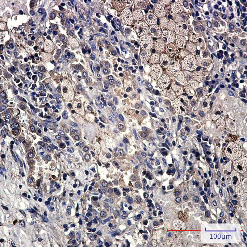 2 - DcR2 Rabbit mAb AP75345