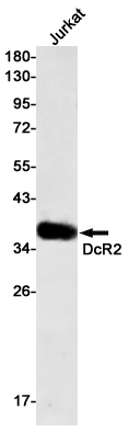 1 - DcR2 Rabbit mAb AP75345