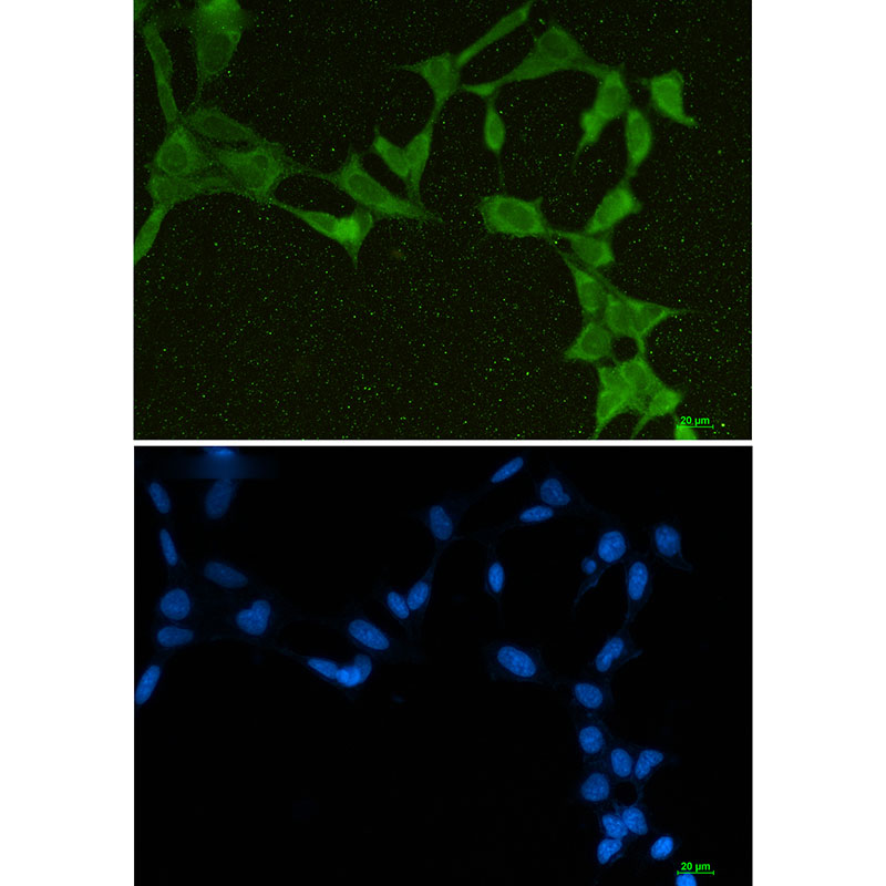 1 - DDX21 Rabbit mAb AP75347