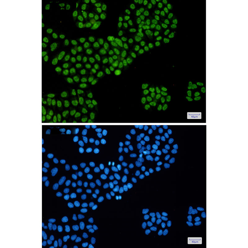 8 - DDX5 Rabbit mAb AP75348