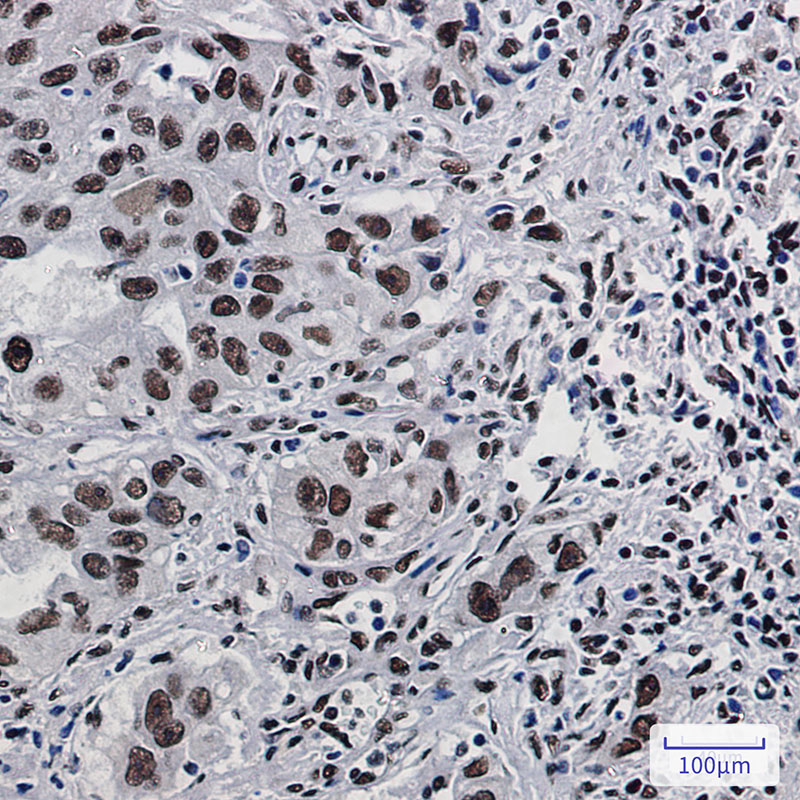 2 - DDX5 Rabbit mAb AP75348