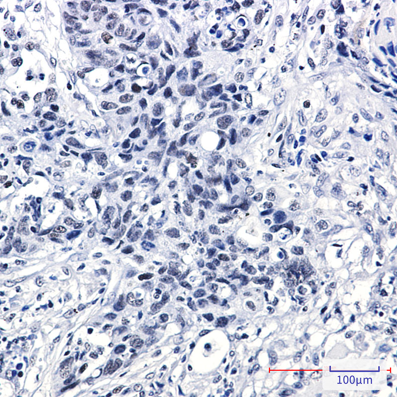 2 - DEK Rabbit mAb AP75349