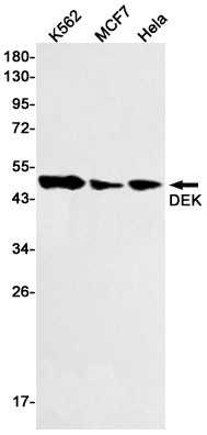 1 - DEK Rabbit mAb AP75349