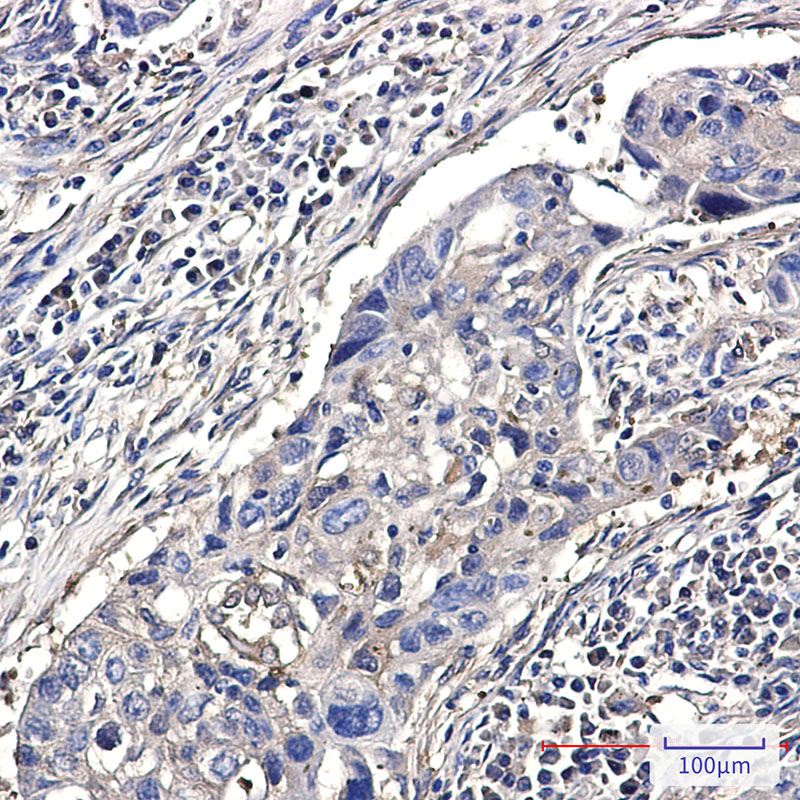 2 - DSTN Rabbit mAb AP75351