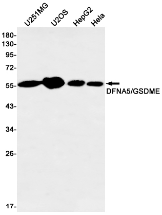1 - DFNA5/GSDME Rabbit mAb AP75352