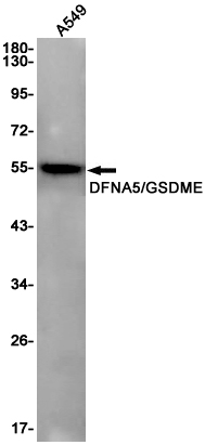 1 - DFNA5/GSDME Rabbit mAb AP75353