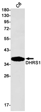 1 - DHRS1 Rabbit mAb AP75356