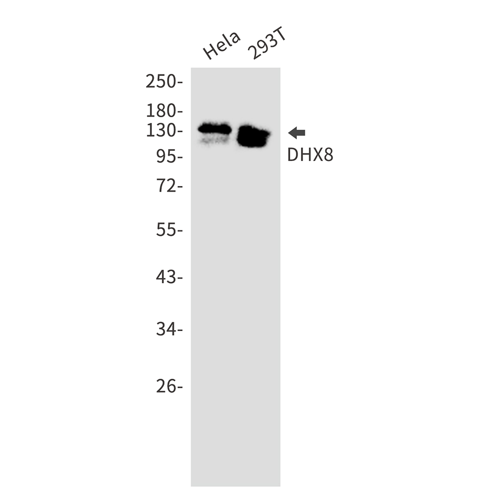 1 - DHX8 Rabbit mAb AP75357