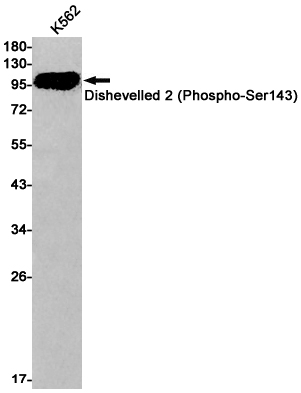 1 - Phospho-Dishevelled 2 (Ser143) Rabbit mAb AP75359